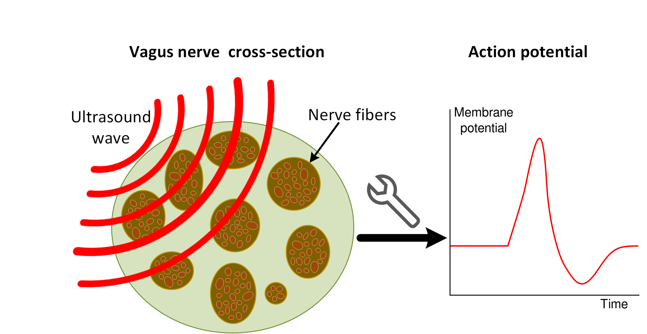 Ultrasound Vagus Nerve Stimulation